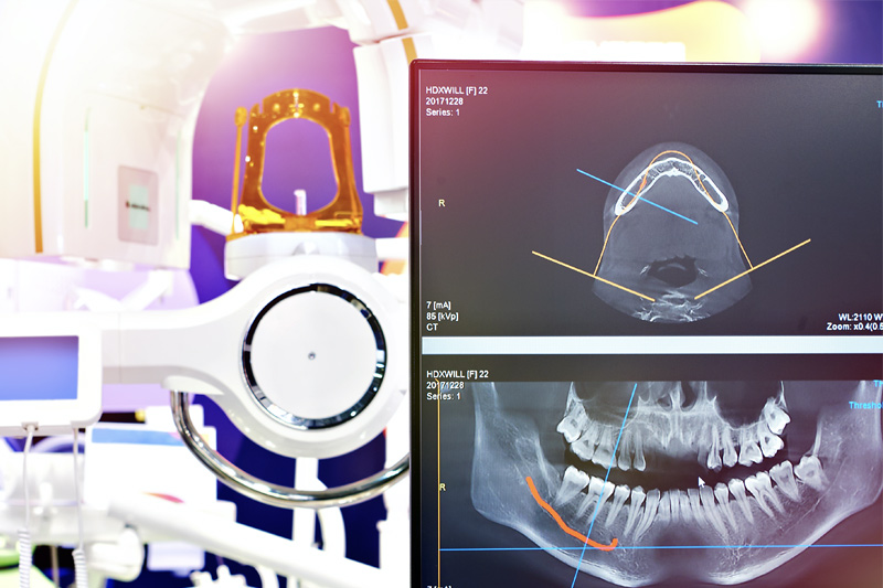 Digital X-Rays in Compton